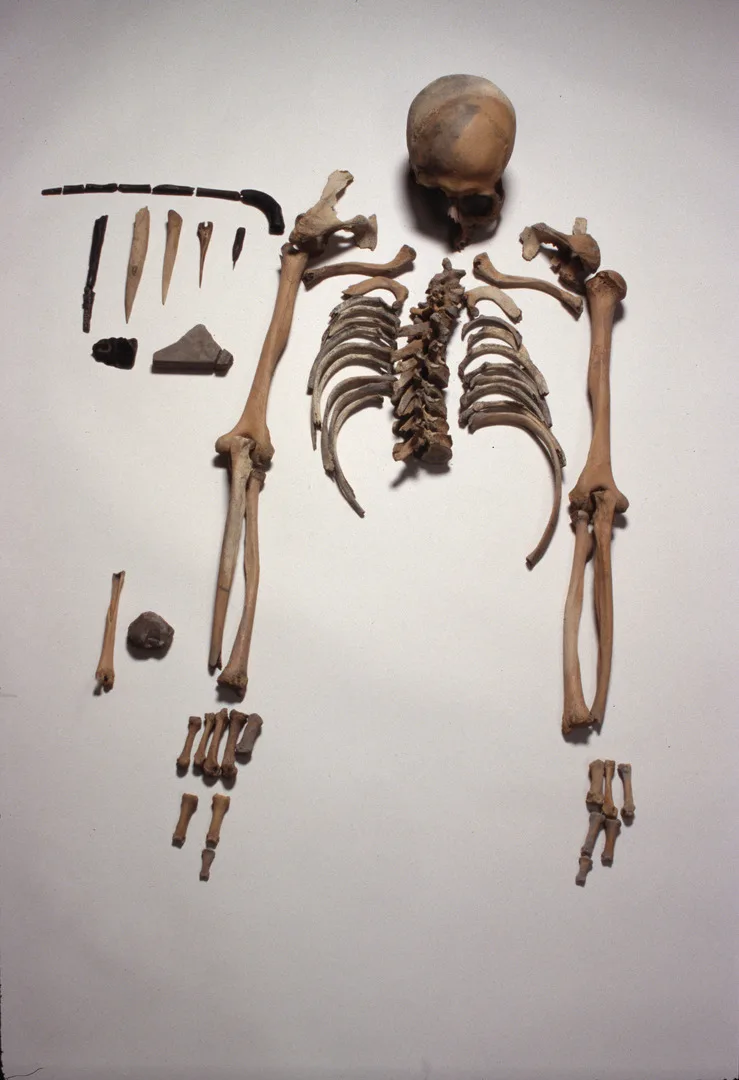 A cranium and bones from the upper part of a man.