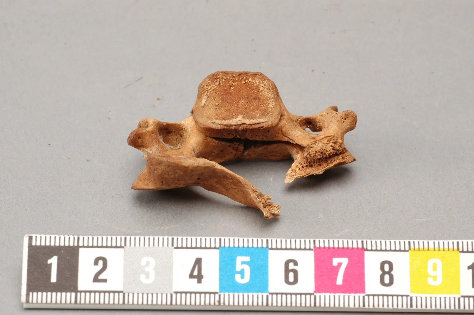 Severed neck vertebra.