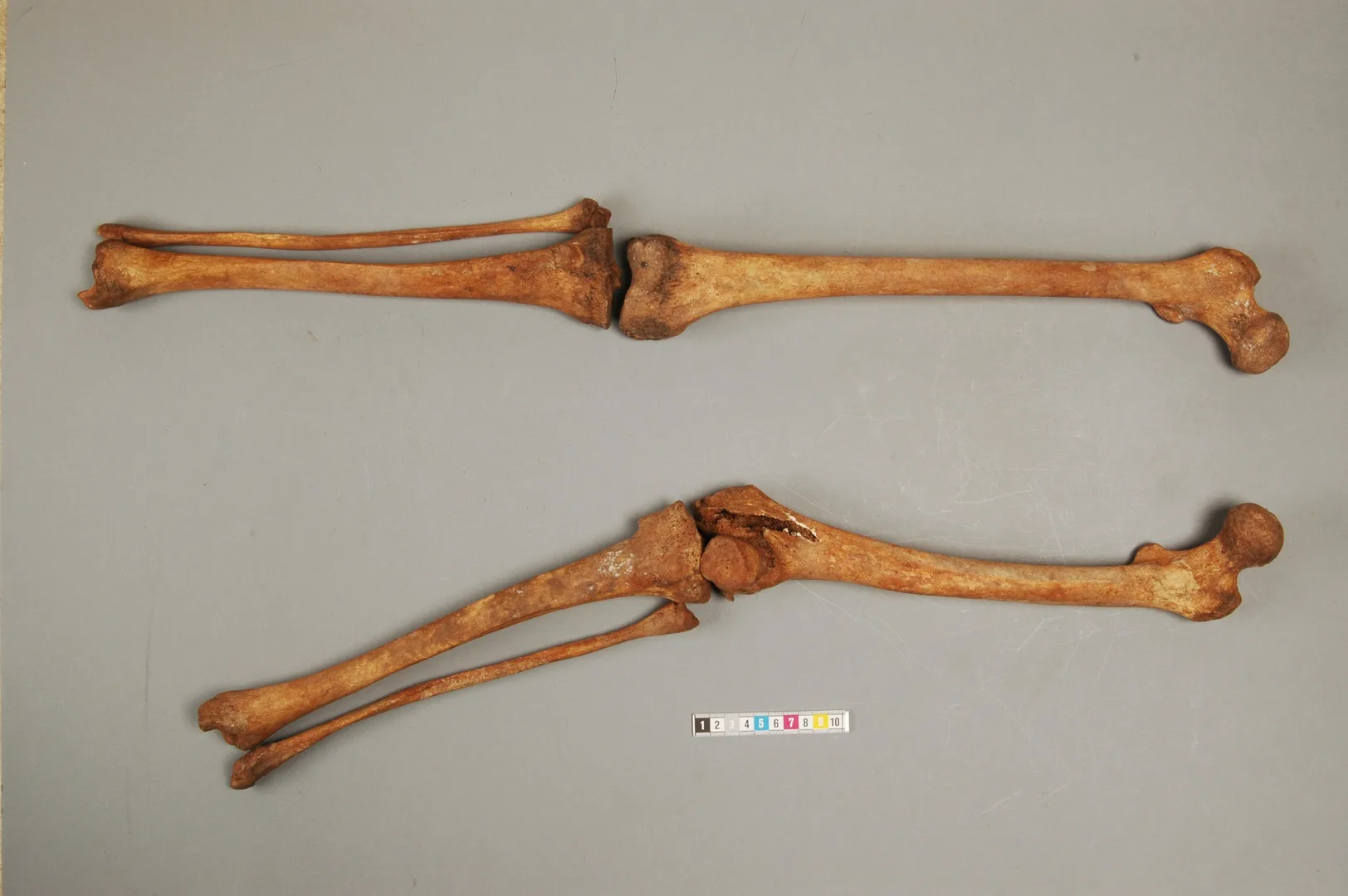 Bild av ben från skelett